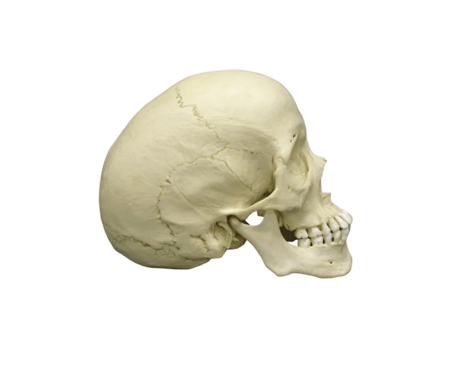 Skaphozephaler Schädel – anschauliches Modell einer Schädeldeformation durch vorzeitige Nahtverknöcherung - Erler - Zimmer