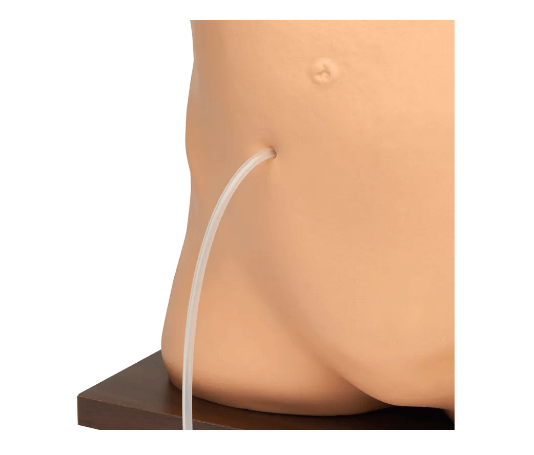 Peritonealdialyse - Simulator - Erler - Zimmer