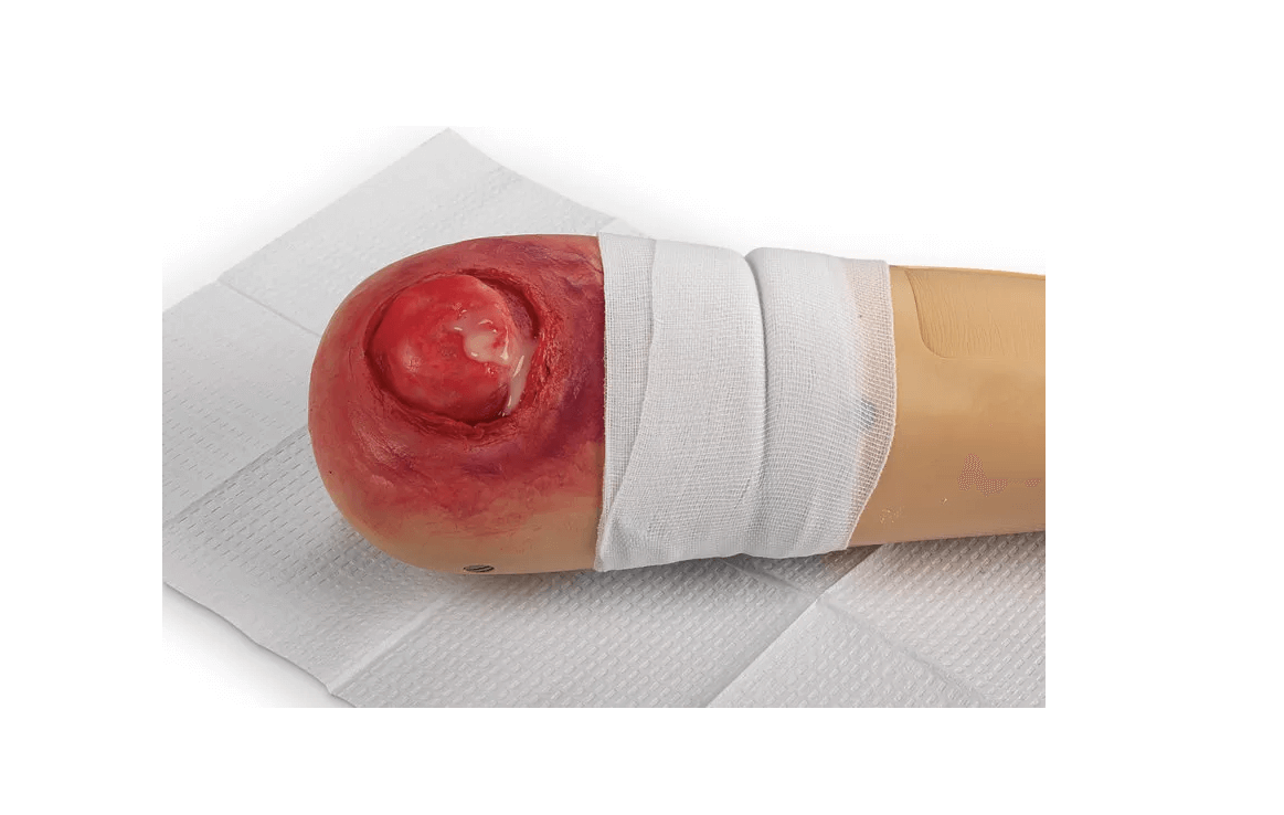 Pflege - Wunden - Simulations - Kit Ultra - Erler - Zimmer
