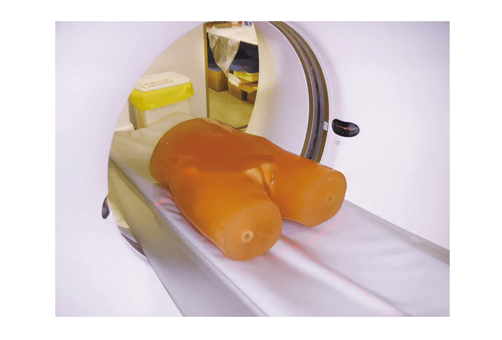 CT Prostata Phantom - Erler - Zimmer