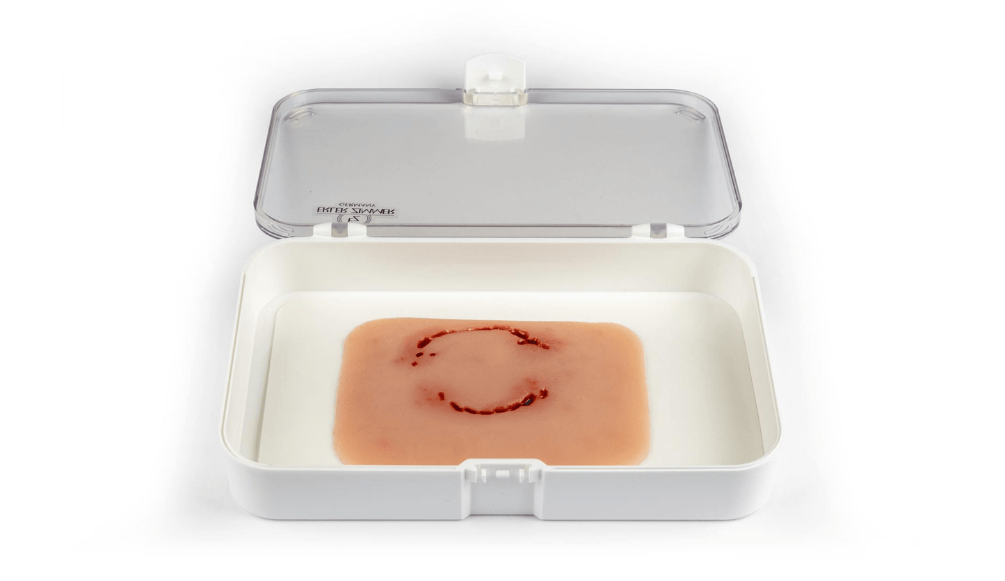Wundmoulage Bisswunde Mensch - Erler - Zimmer