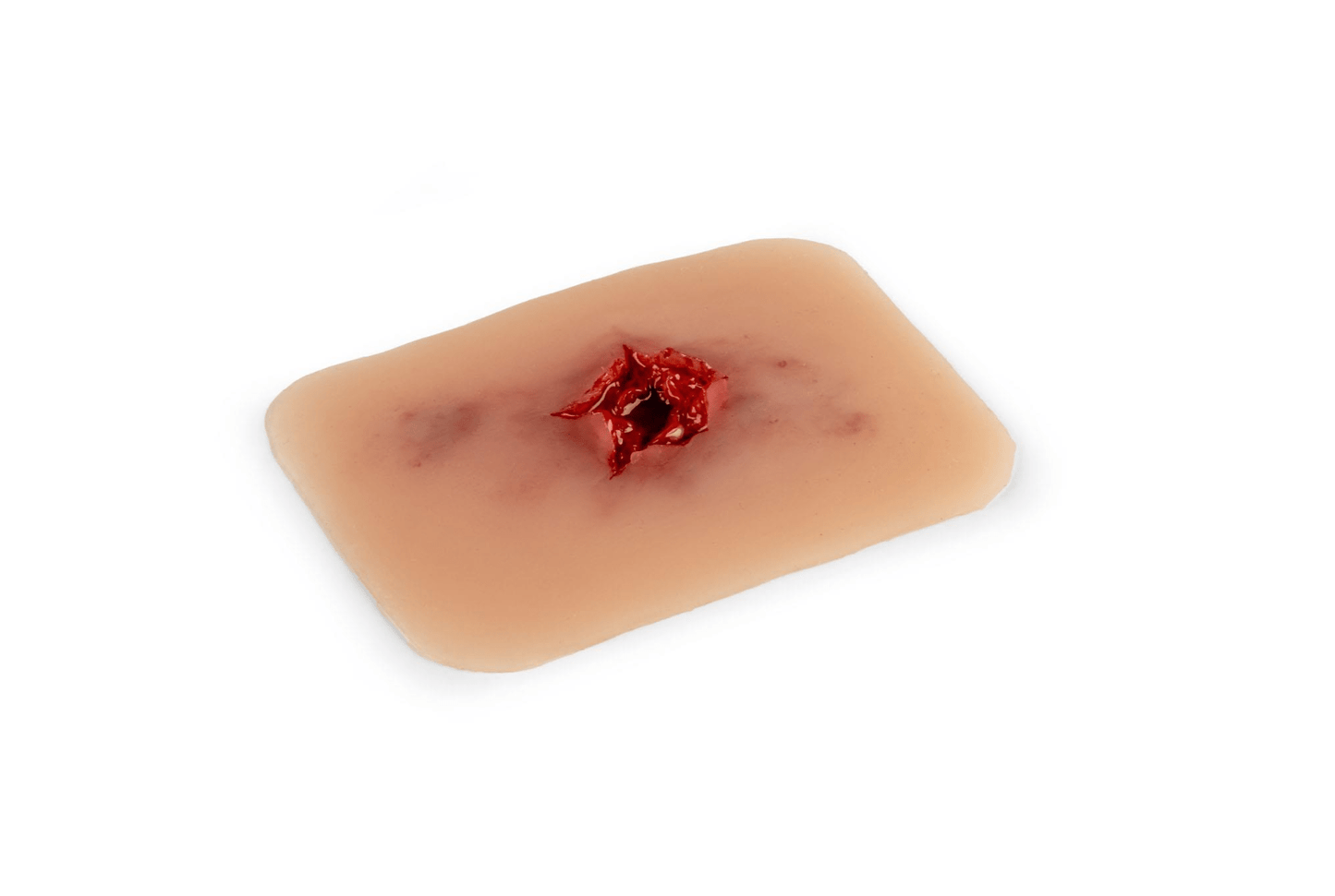 Wundmoulage Schuß Austrittswunde - Erler - Zimmer