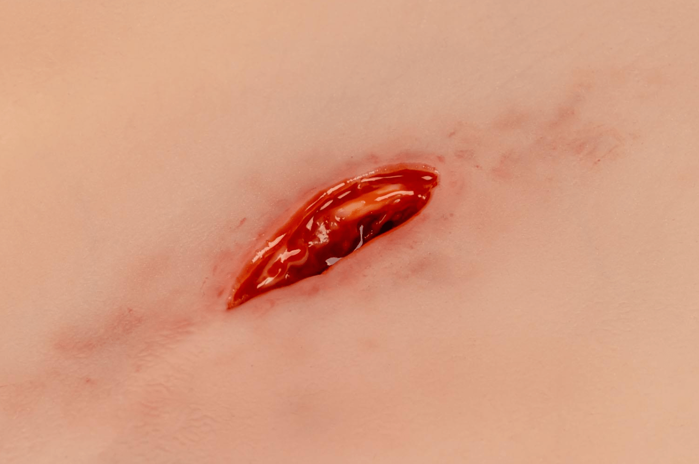 Wundmoulage Stichwunde mit Blutungsfunktion - Erler - Zimmer