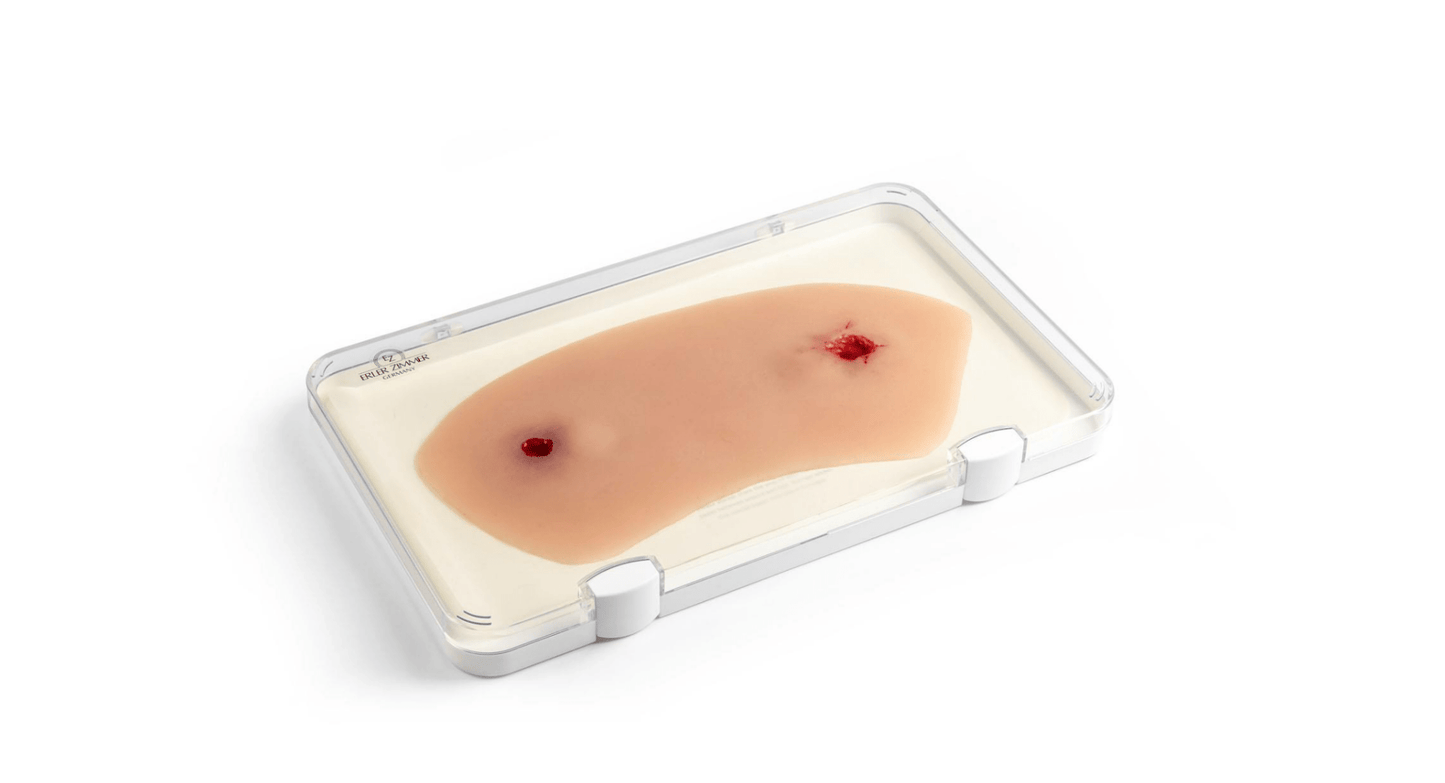 Wundmoulage Schuß Sprunggelenk - Erler - Zimmer