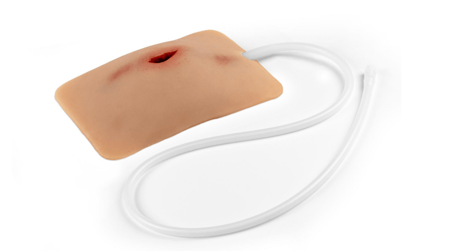 Wundmoulage Stich Leiste, Wound Packing - Erler - Zimmer