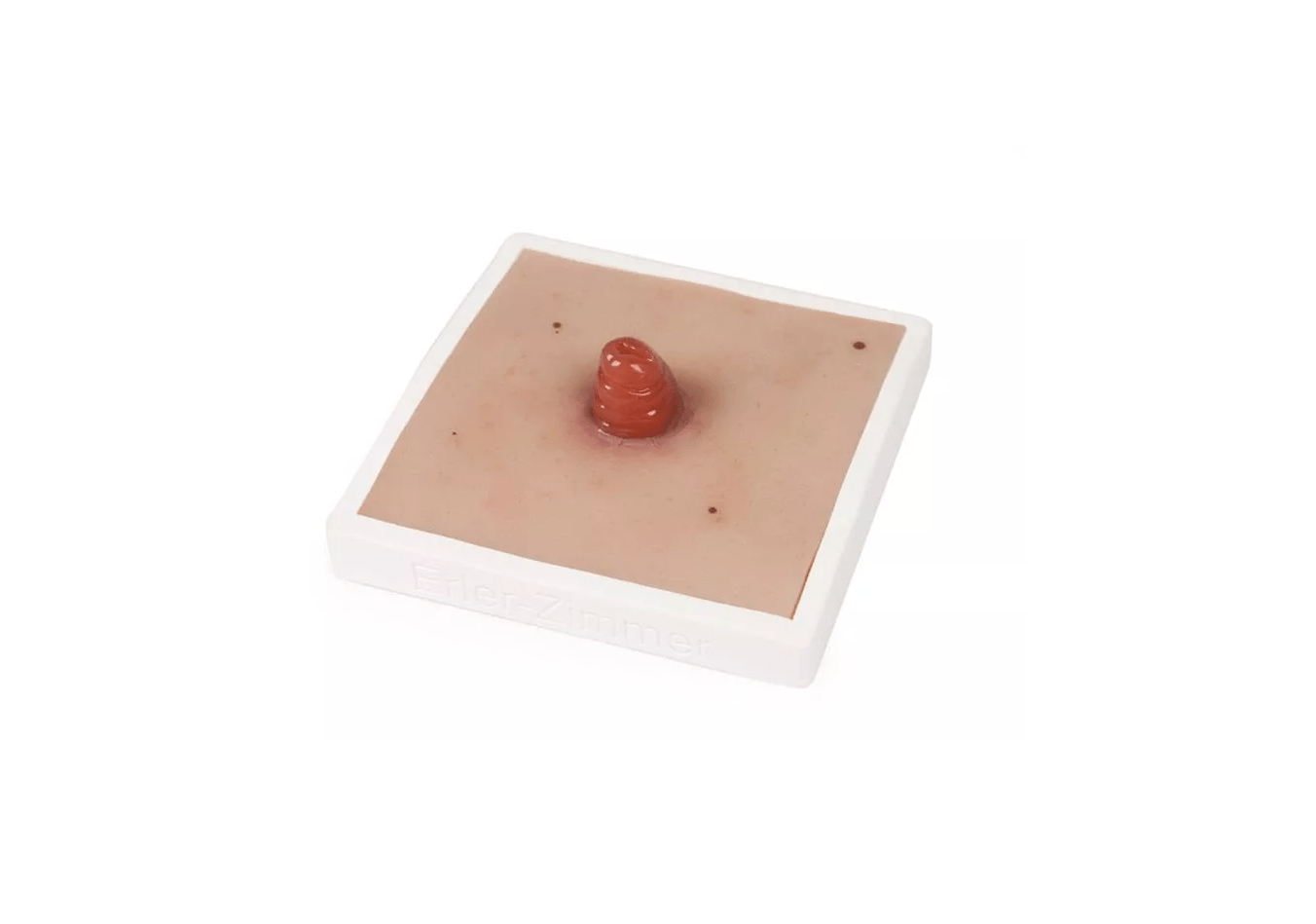 Wundmoulage Ileostoma, inkl. Stativ - Erler - Zimmer