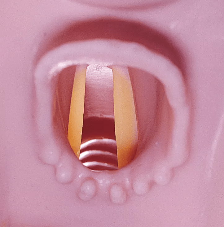 Airway Larry Atemweg - Trainer für R10052 - Erler - Zimmer