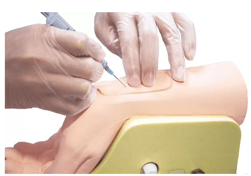 Handgelenk zur Arterienpunktion - Erler - Zimmer