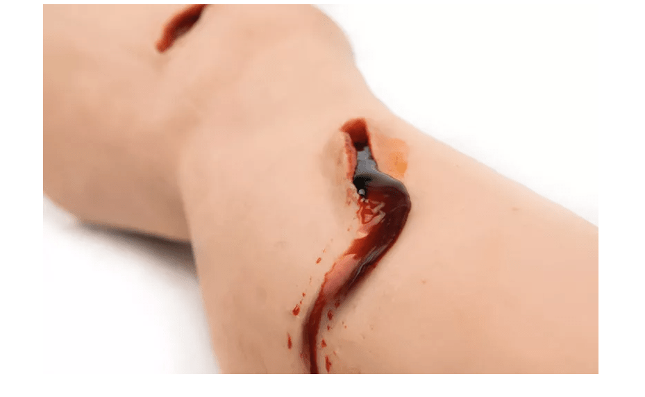Trauma Bein Tasktrainer - Erler - Zimmer