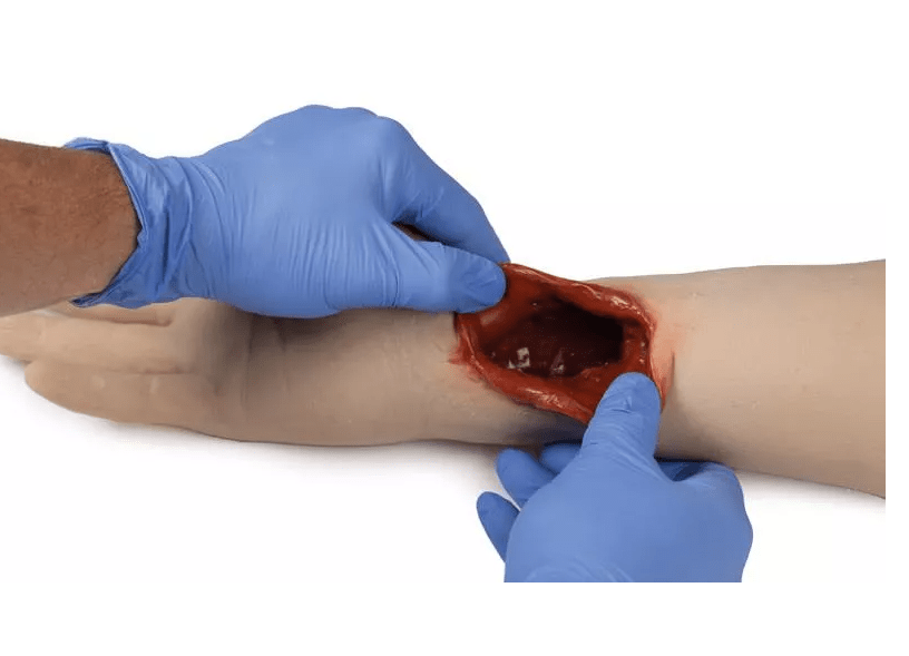Trauma Arm Tasktrainer - Erler - Zimmer