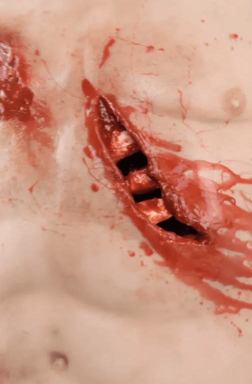 Trauma Training Torso - Erler - Zimmer