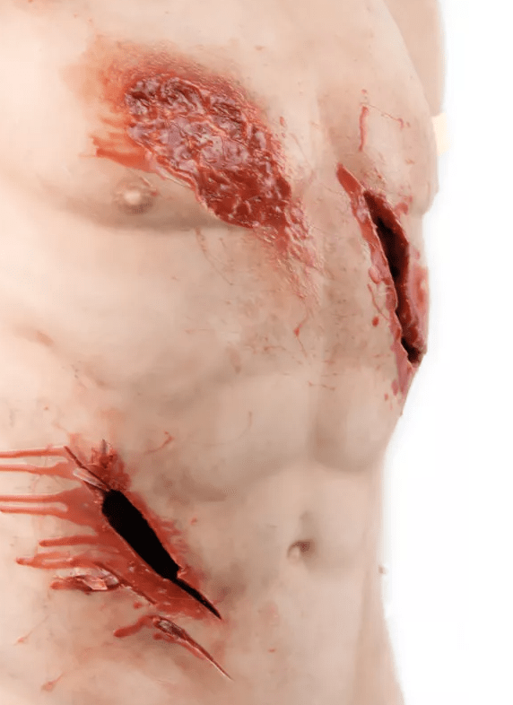 Trauma Training Torso - Erler - Zimmer