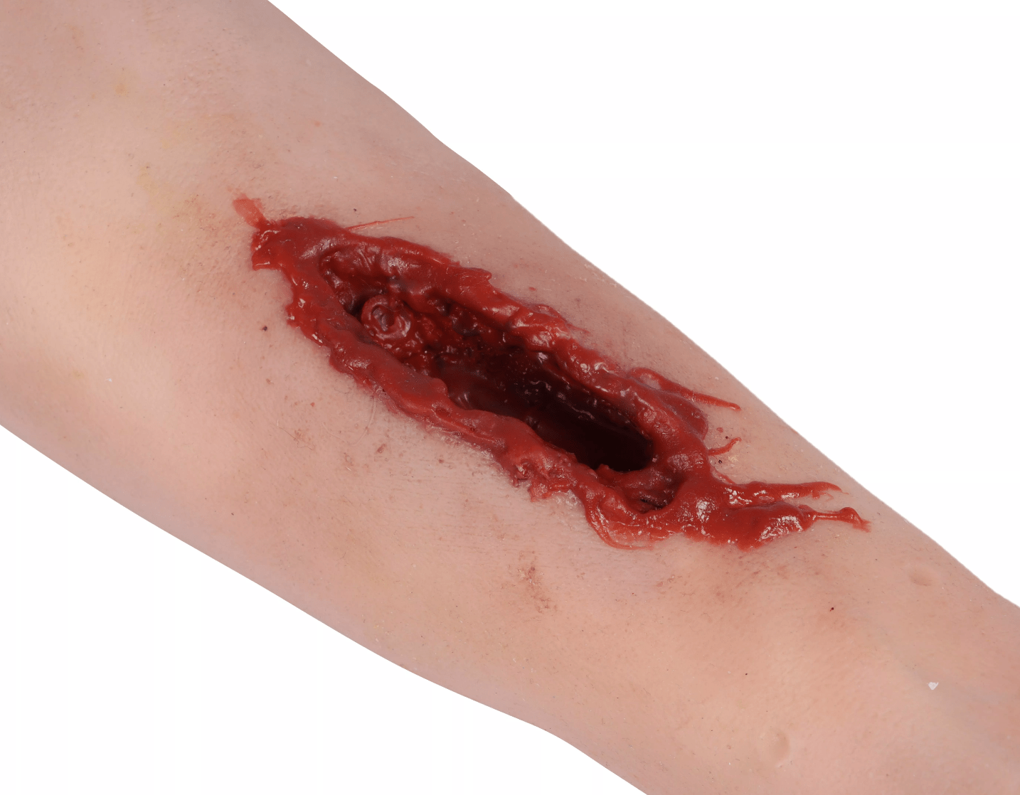 Trauma Arm Risswunde Task Trainer - Erler - Zimmer