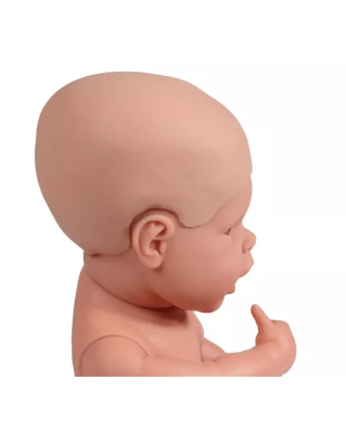 Hydrocephalus Überzug für Babypuppen - Erler - Zimmer