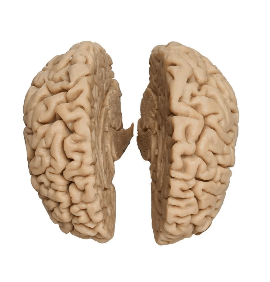 Menschliches Gehirn, Naturabguss - Erler - Zimmer