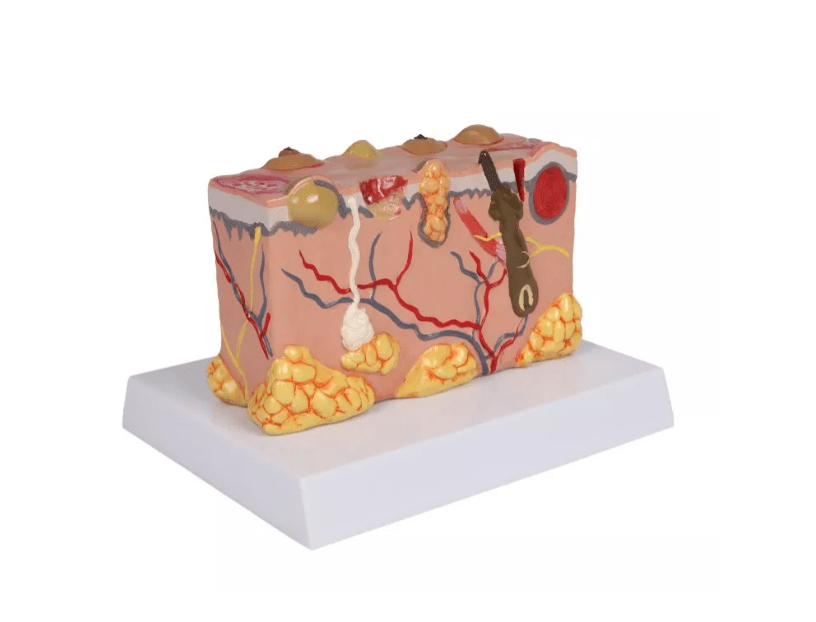 Pathologisches Hautmodel - Erler - Zimmer