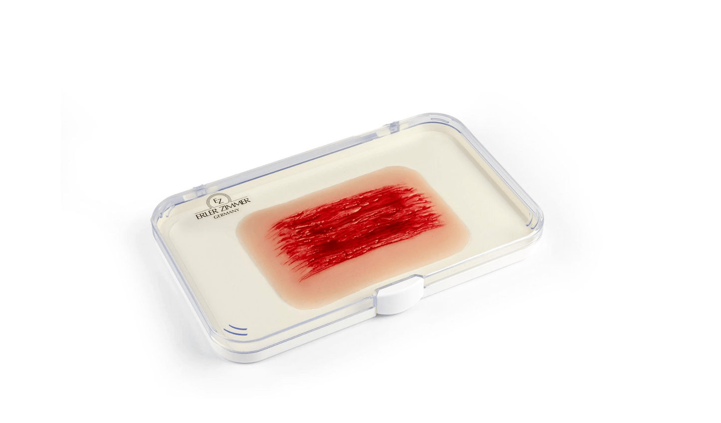 Wundmoulage Schürfwunde - Erler - Zimmer