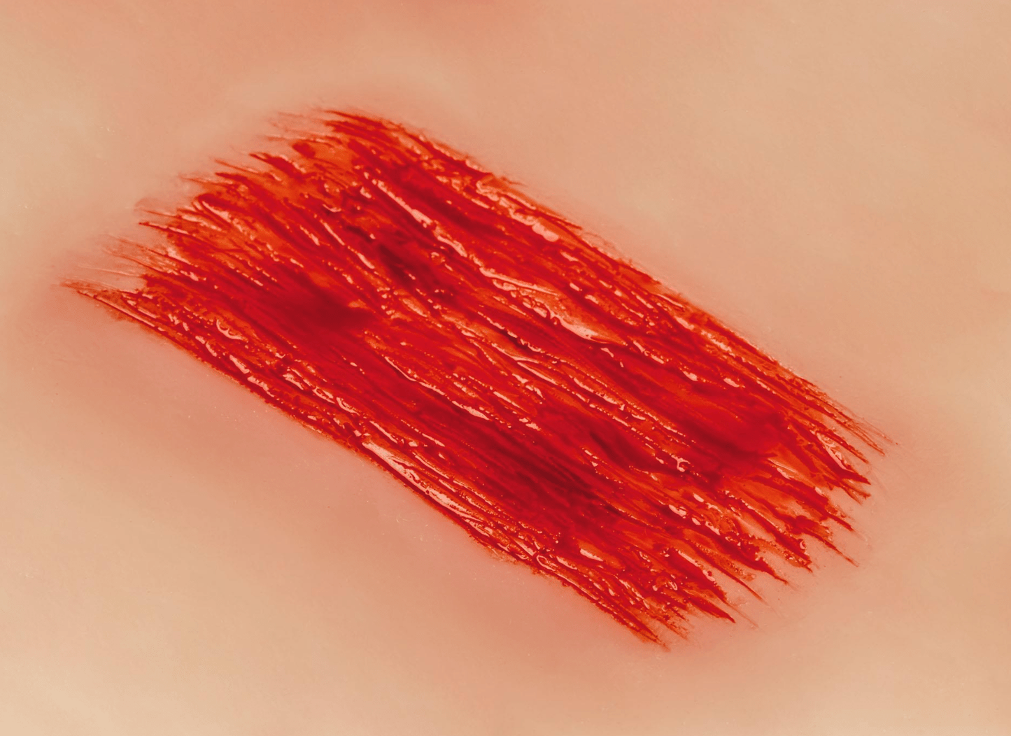 Wundmoulage Schürfwunde - Erler - Zimmer