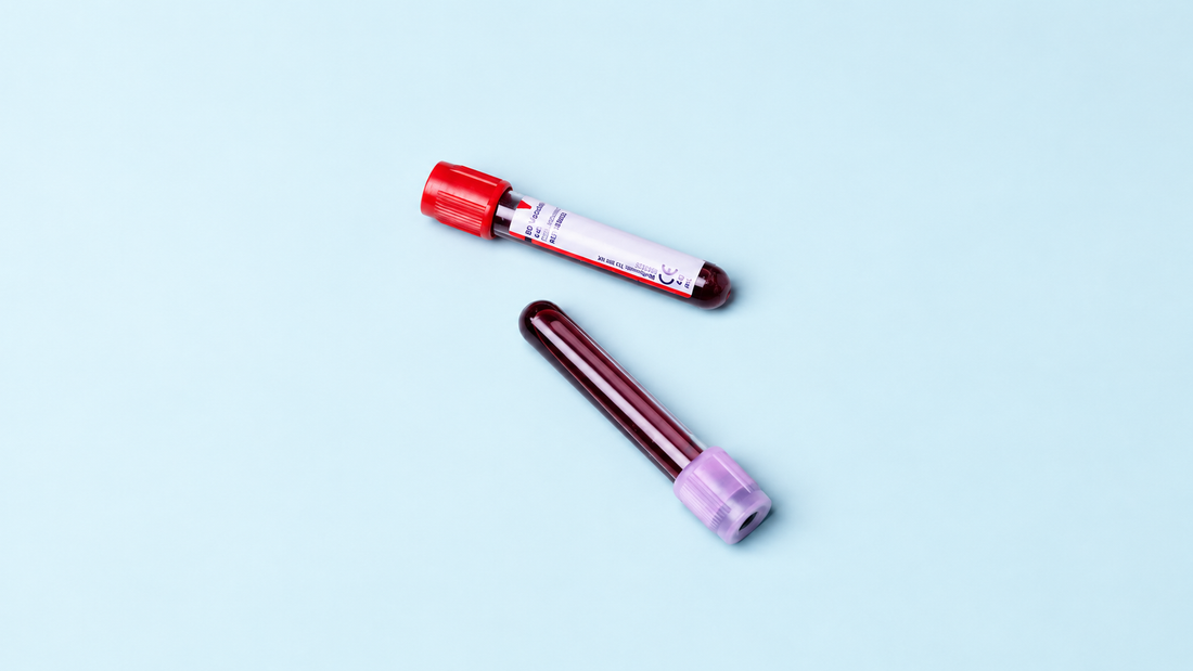 Welches Blutentnahmeröhrchen brauche ich? EDTA, Citrat, Heparin oder Serum?