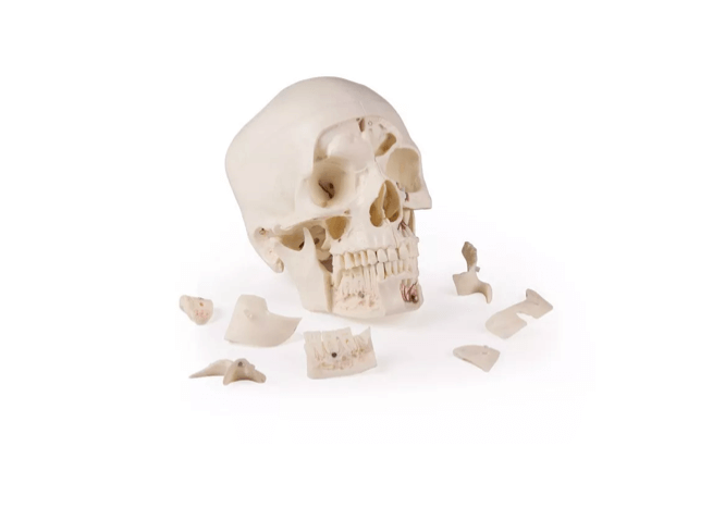 Luxus Demonstrations - Schädel, 14 - teilig – Premium - Lehrmodell für erweiterte anatomische Studien - Erler - Zimmer