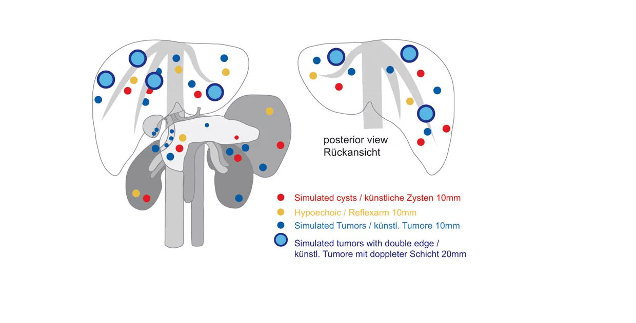 Ultraschall - Übungsmodell Anatomie / Pathologie - Erler - Zimmer