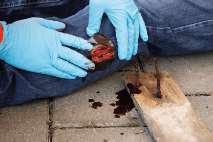 Wundmoulage Schnittwunde - Erler - Zimmer