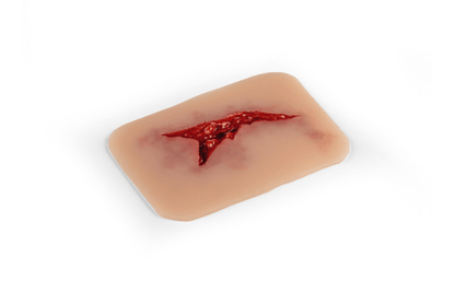 Wundmoulage Risswunde - Erler - Zimmer