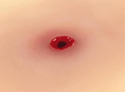 Wundmoulage Einschußwunde - Erler - Zimmer