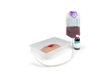 Wundmoulage wound packing - Erler - Zimmer