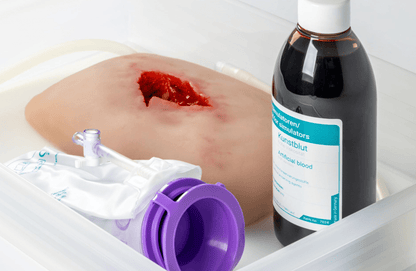 Wundmoulage wound packing - Erler - Zimmer