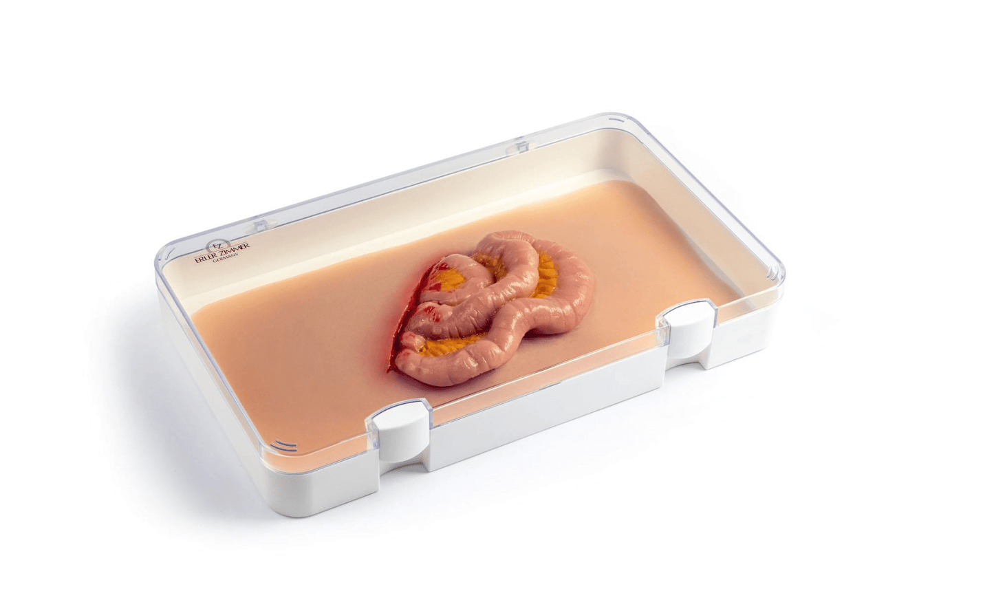 Wundmoulage Dünndarmaustritt - Erler - Zimmer