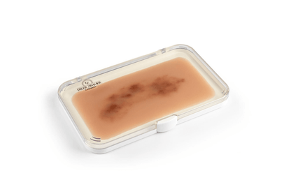 Wundmoulage Hämatom frisch - Erler - Zimmer