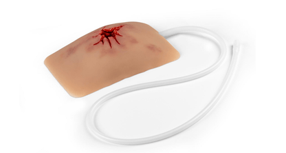 Wundmoulage Schuß Leiste, Wound Packing - Erler - Zimmer