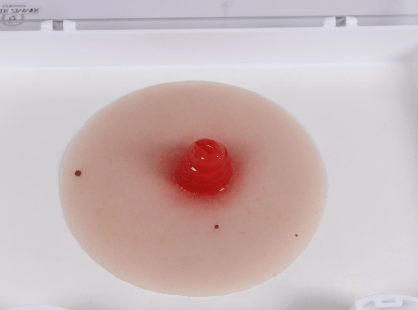 Wundmoulage Ileostoma, selbsthaftend - Erler - Zimmer