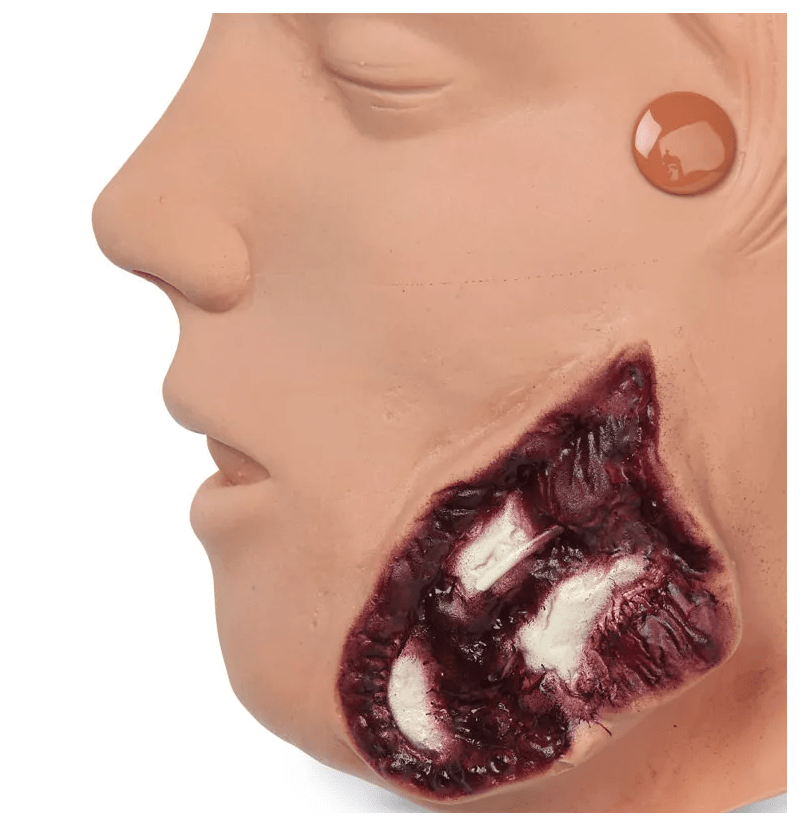 Wundsimulations - Set für Puppen - Erler - Zimmer