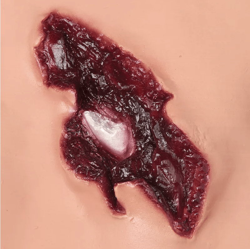 Wundsimulations - Set für Puppen - Erler - Zimmer
