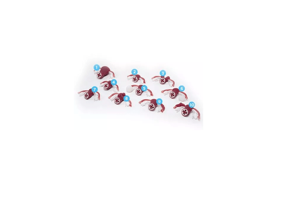 Uteri mit externen tastbaren abnormalen Patholgien für R10188 - Erler - Zimmer