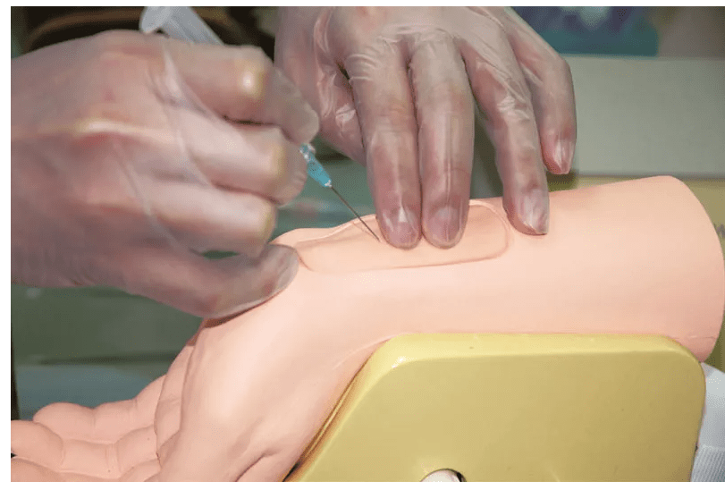 Handgelenk zur Arterienpunktion - Erler - Zimmer