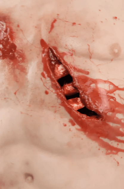 Trauma Training Torso - Erler - Zimmer