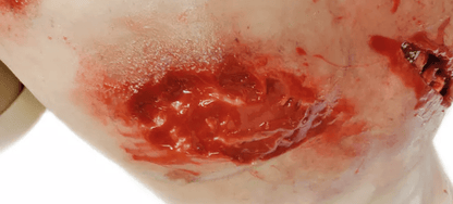 Trauma Training Torso - Erler - Zimmer