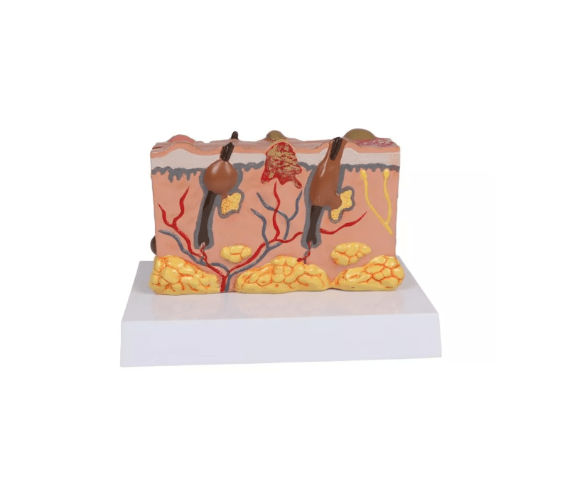 Pathologisches Hautmodel - Erler - Zimmer