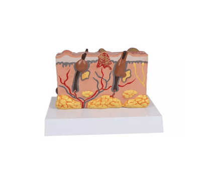 Pathologisches Hautmodel - Erler - Zimmer
