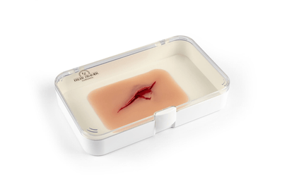 Wundmoulage Schnittwunde mit Glassplitter - Erler - Zimmer