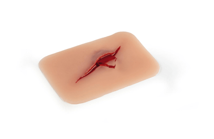 Wundmoulage Schnittwunde mit Glassplitter - Erler - Zimmer