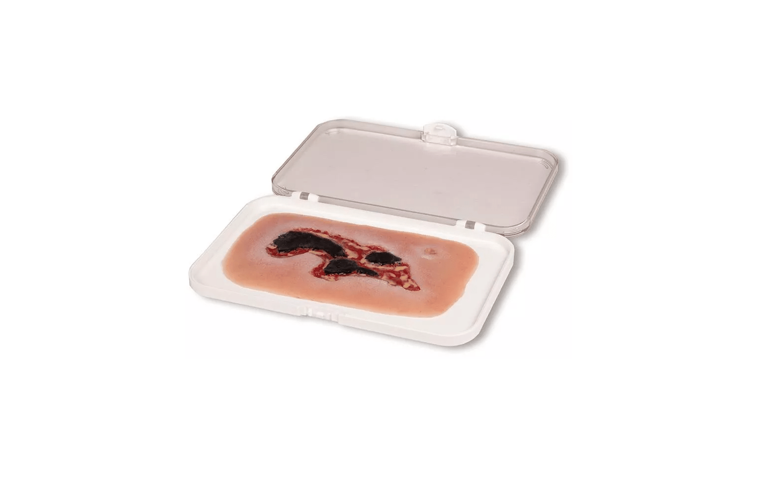 Wundmoulage Ulcus Cruris Arteriosum - Erler - Zimmer