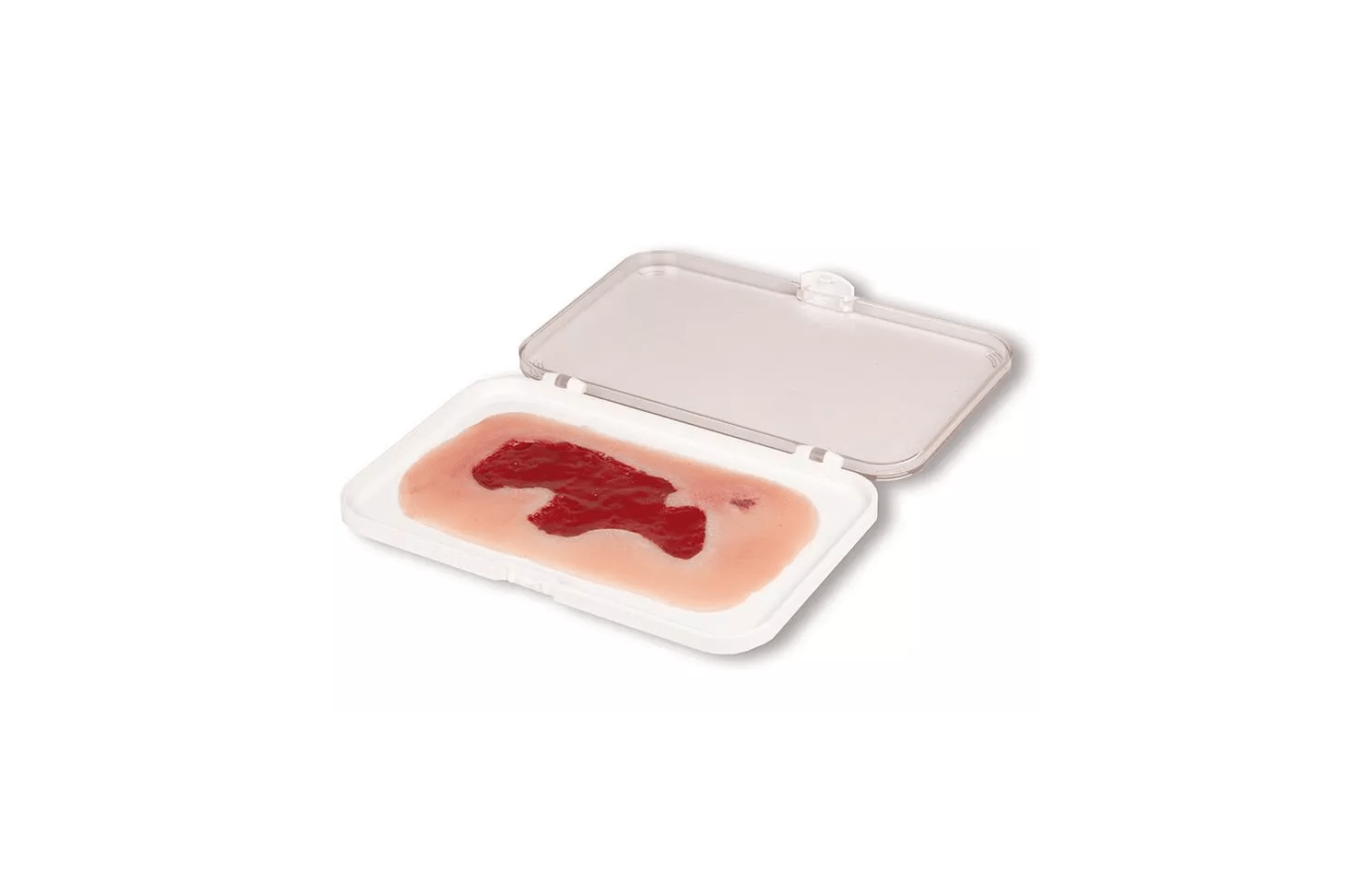 Wundmoulage Ulcus Cruris Arteriosum - Erler - Zimmer
