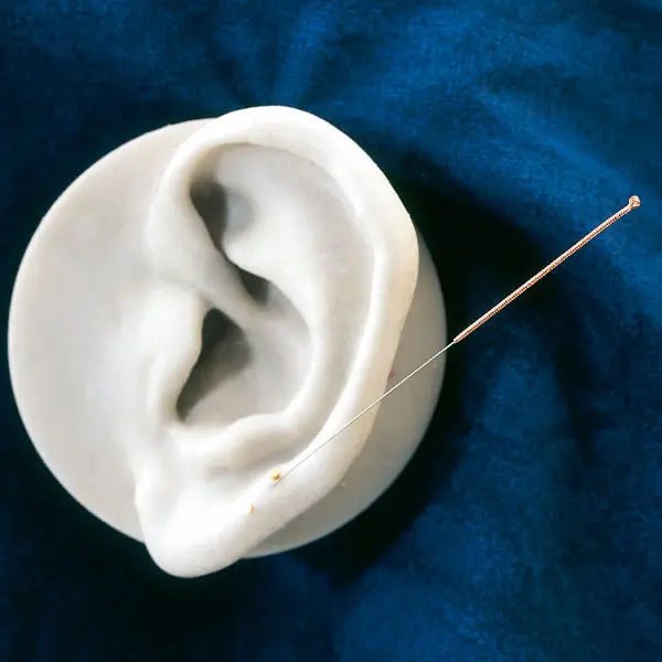 ServopraxAkupunkturnadeln KupfergriffDocMed GmbH