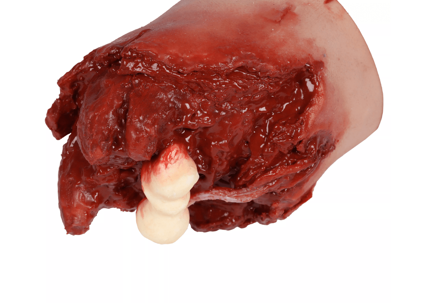 Erler-ZimmerAmputierter Arm Task TrainerDocMed GmbH