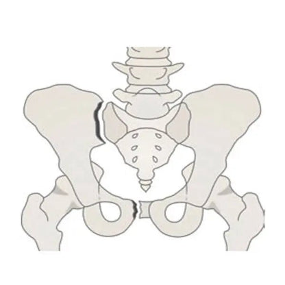 VBM Medizintechnik GmbHBeckenschlingeDocMed GmbH