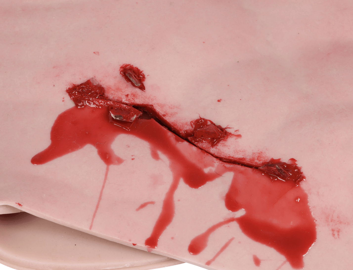 Erler-ZimmerBrusthaut mit Schrapnellwunde zum UmschnallenDocMed GmbH
